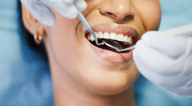 Best Pediatric Emergency Dentist in Cypress Lake, FL