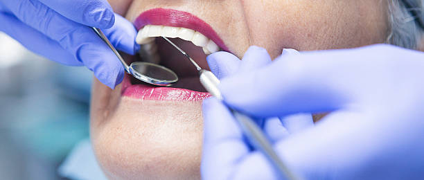Best Weekend Emergency Dentist in Cypress Lake, FL